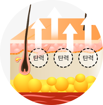 마이크로 니들
