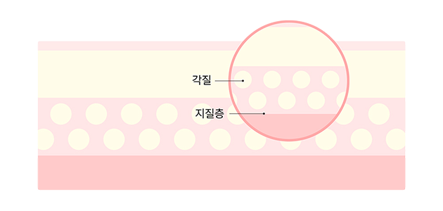마이크로 니들