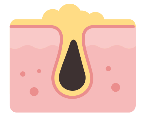 content_etosome1