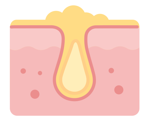 content_etosome1